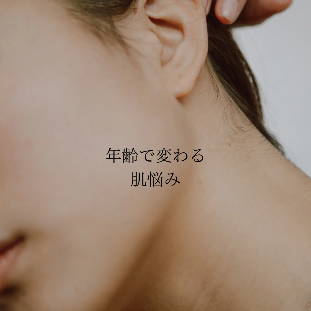 年齢で変わる肌悩み」と書かれた画像。女性のフェイスラインと首元のアップが写っており、ナチュラルで落ち着いた雰囲気の写真。